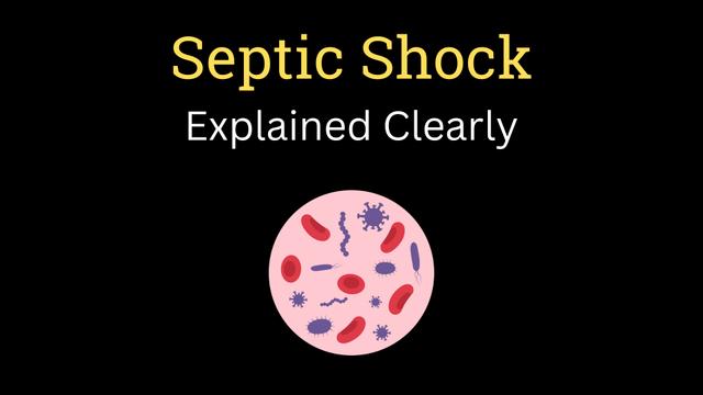 Septic shock