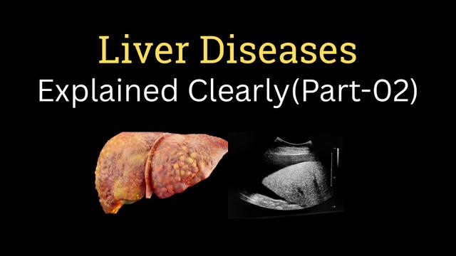 Liver Disease Explained Clearly