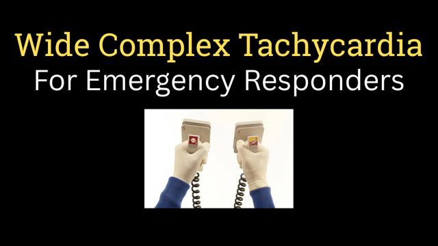 Wide complex tachycardia